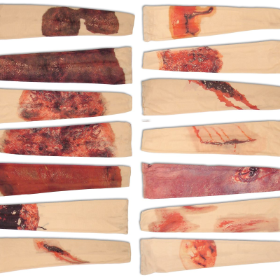 Rapid - simulacija ozljeda